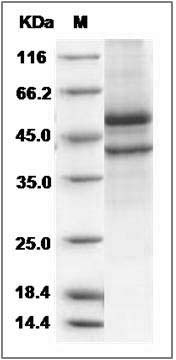 Human SPOCK1 / Testican 1 Protein (aa 21-429, His Tag) SDS-PAGE