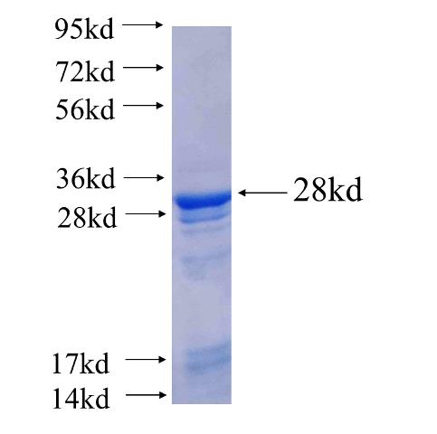 Recombinant human C7orf50(Full length) SDS-PAGE