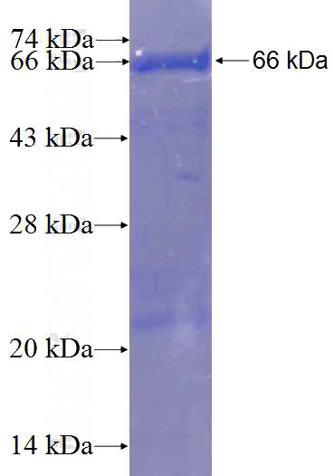 Recombinant Human C17orf75 SDS-PAGE