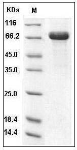 Human DC-SIGN / CD209 Protein (Fc Tag) SDS-PAGE