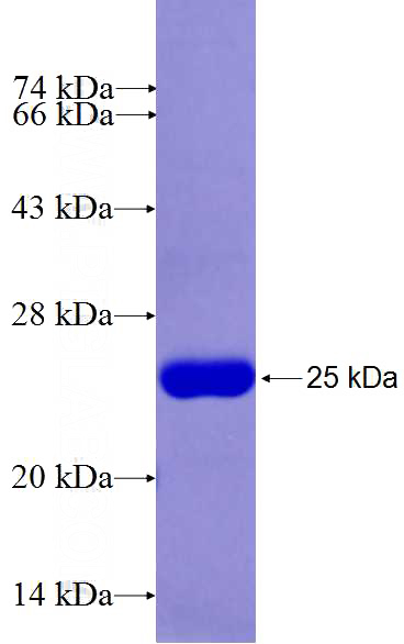 Recombinant Human DHTKD1 SDS-PAGE