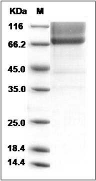 Mouse Biglycan / PG-S1 / BGN Protein (Fc Tag) SDS-PAGE