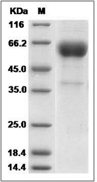 Cynomolgus CD153 / CD30L / TNFSF8 Protein (Fc Tag) SDS-PAGE