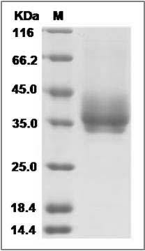 Rat B7-DC / PD-L2 / CD273 Protein (His Tag) SDS-PAGE
