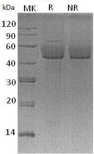 Human SDC1/SDC (His tag) recombinant protein