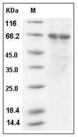 Human PLK1 / PLK-1 Protein (His Tag) SDS-PAGE