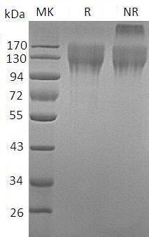 Mouse Cd96 (His tag) recombinant protein