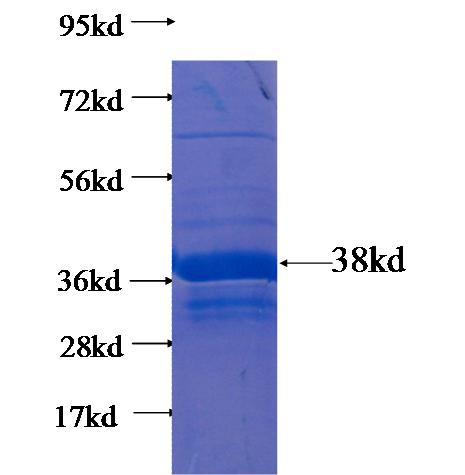 Recombinant human REM2 SDS-PAGE