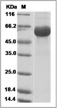 Influenza A H6N8 (A/mallard/Ohio/217/1998) Hemagglutinin / HA Protein (His Tag) SDS-PAGE