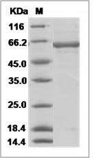 Influenza A H5N1 (A/Cambodia/R0405050/2007) Hemagglutinin / HA Protein (His Tag)
