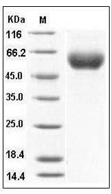 Human IL-1RAcP / IL-1R3 Protein (His Tag) SDS-PAGE