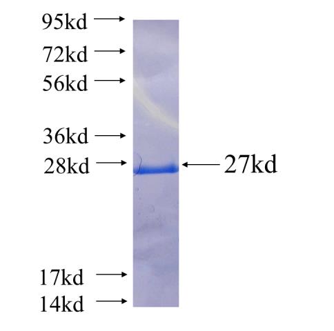 Recombinant human LIN7C(Full length) SDS-PAGE