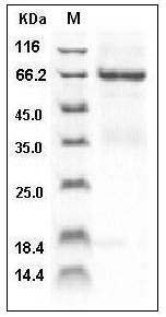 Human TNFRSF4 / OX40 / CD134 Protein (His & Fc Tag) SDS-PAGE