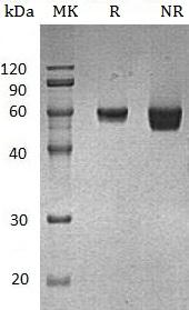 Human GLUL/GLNS (His tag) recombinant protein