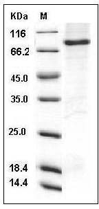 Human DYRK3 / REDK Protein (His & GST Tag) SDS-PAGE