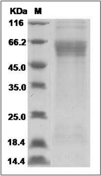 Influenza A H9N2 (A/HongKong/1073/99) Hemagglutinin Protein (HA1 Subunit) (His Tag) SDS-PAGE