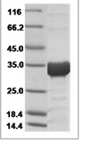 Human SDCBP recombinant protein (N-His)