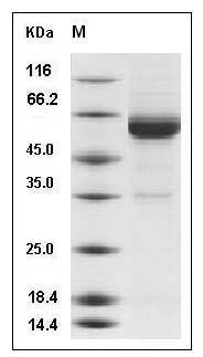 Human IL17RC Protein (aa 1-454, His Tag) SDS-PAGE