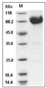 Mouse IL10RB / IL10R2 Protein (Fc Tag) SDS-PAGE
