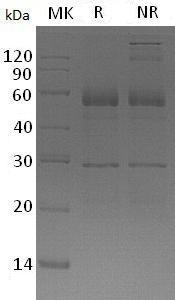 Human SEMG1/SEMG (His tag) recombinant protein