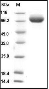 Influenza A H1N1 (A/Brisbane/59/2007) Hemagglutinin / HA Protein (His Tag) SDS-PAGE