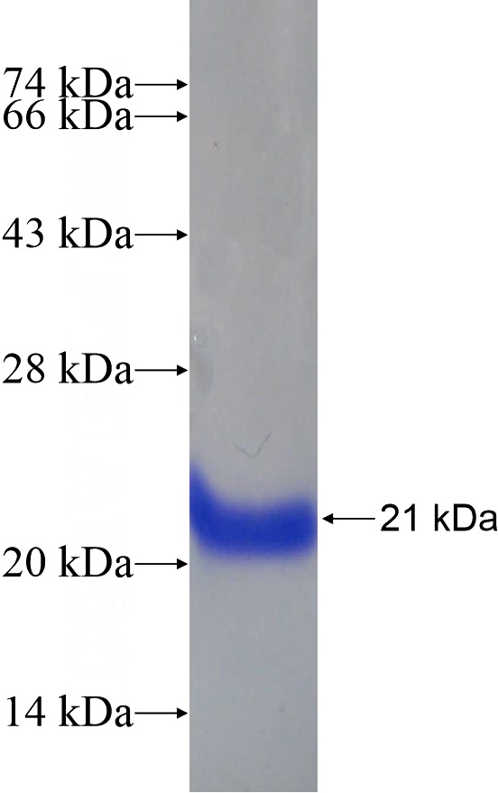 Recombinant Human FAM98B SDS-PAGE