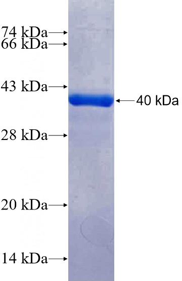 Recombinant Human OLIG1 SDS-PAGE