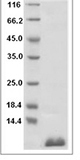 Human S100P recombinant protein (Native)