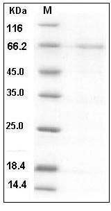 Human Lefty2 / Lefty A Protein (Fc Tag) SDS-PAGE