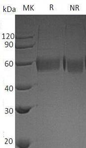 Human CD274/B7H1/PDCD1L1/PDCD1LG1/PDL1 (Flag tag) recombinant protein