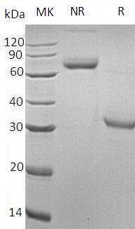 Human OLR1/CLEC8A/LOX1 (His tag) recombinant protein