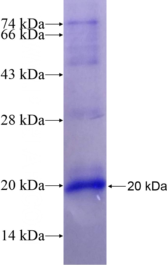 Recombinant Human SLC5A11 SDS-PAGE