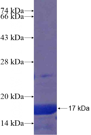 Recombinant Human CCDC123 SDS-PAGE