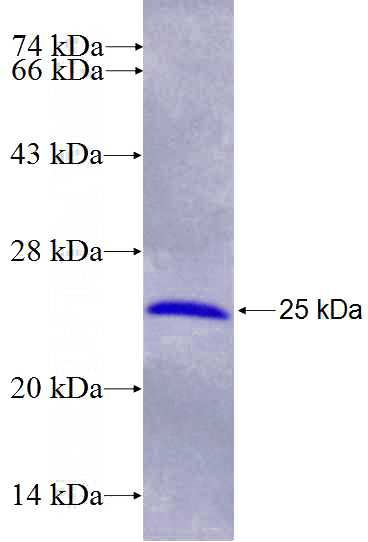 Recombinant Human PLCZ1 SDS-PAGE
