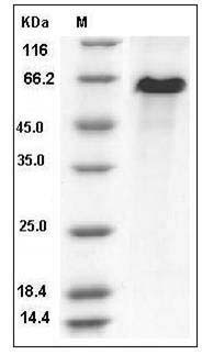 Rat DLL1 / Delta-like Protein 1 Protein (His Tag) SDS-PAGE