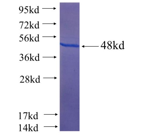 Recombinant human C22orf33(Full length) SDS-PAGE