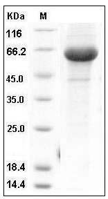 Influenza A H5N1 (A/bar-headed goose/Qinghai/14/2008) Hemagglutinin / HA Protein (His Tag) SDS-PAGE