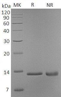 Mouse S100a4/Capl/Mts1 (His tag) recombinant protein