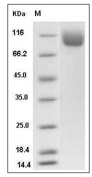 Mouse NAALADL1 Protein (His Tag) SDS-PAGE