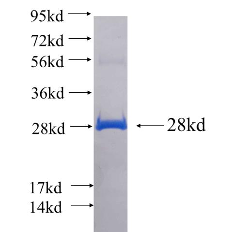 Recombinant human CCDC158 SDS-PAGE
