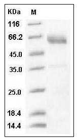 Human SMOC1 Protein (His Tag) SDS-PAGE