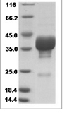 CV Coxsackievirus A16 VP4 Protein 15523