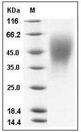 Human OSTM1 Protein (His Tag) SDS-PAGE