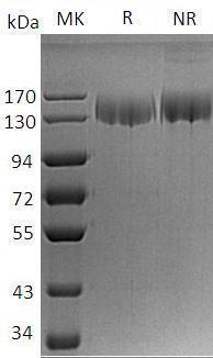 Human ITGA5/FNRA (His tag) recombinant protein