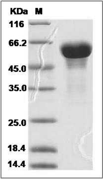 Human SCG3 / Secretogranin 3 Protein (His Tag) SDS-PAGE