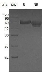 Human AHSG/FETUA/PRO2743 (His tag) recombinant protein