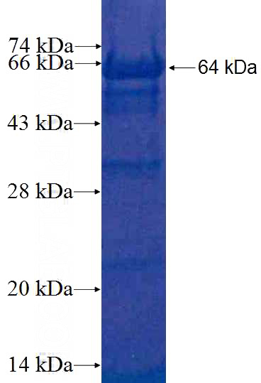 Recombinant Human ATP6V1B2 SDS-PAGE