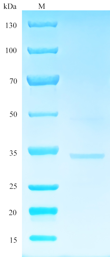 Recombinant Human ELN SDS-PAGE