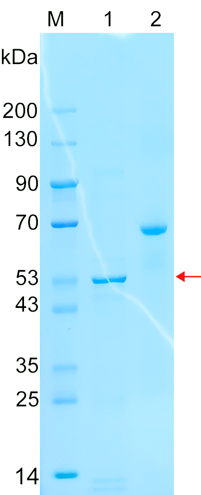 Recombinant AP1M1 protein (His tag) SDS-PAGE