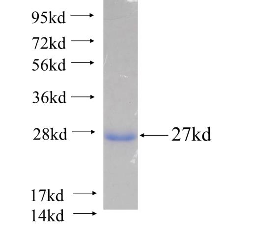 Recombinant human PPPDE1(Full length) SDS-PAGE